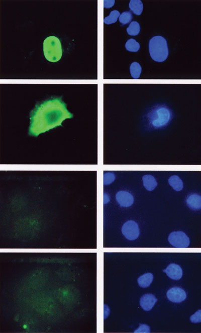 Figure 1. Immunofluorescence staining of Cos -1 cells transfected with (top to bottom) full length hLEF-1, a LEF-1 mutant missing the nuclear localization signal, TCF-4 and TCF -1. Cells were stained with Exalpha’s LEF-1 antibody, clone REMB1 cat. # T100M and visualized with FITC conjugated mouse IgG. DAPI was used to detect all nuclei. The LEF-1 clone REMB1 recognized an epitope in the beta catenin binding domain that is present only in LEF-1
